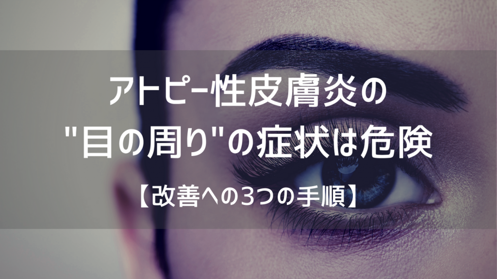 アトピー性皮膚炎の"目の周り"の症状は危険
