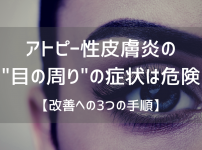 アトピー性皮膚炎の"目の周り"の症状は危険
